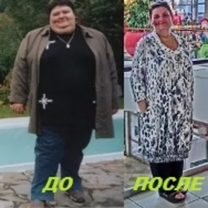 лечение ожирения