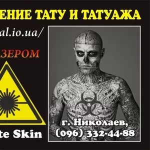 Лазерное удаление tattoo и перманентного tattooажа Николаев